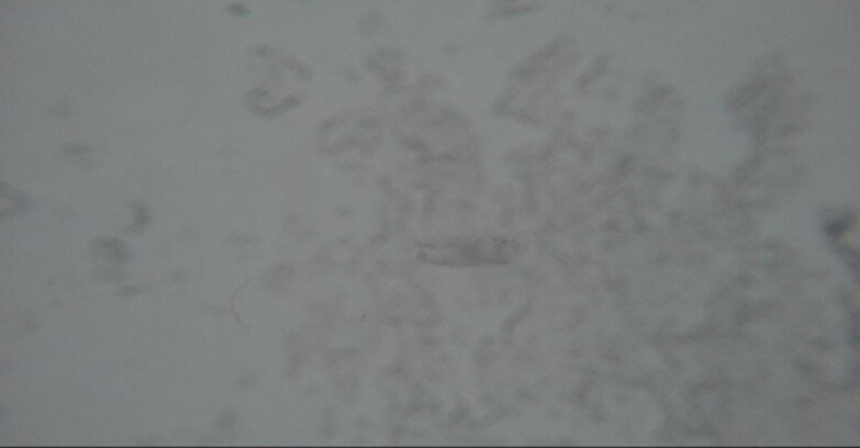 Webcam Moena-Alpe Lusia  - Seggiovia Piavac